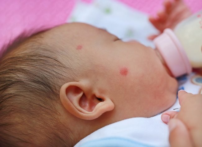 7 Rekomendasi Susu Tinggi Nutrisi untuk Anak Pengidap Alergi Susu Sapi